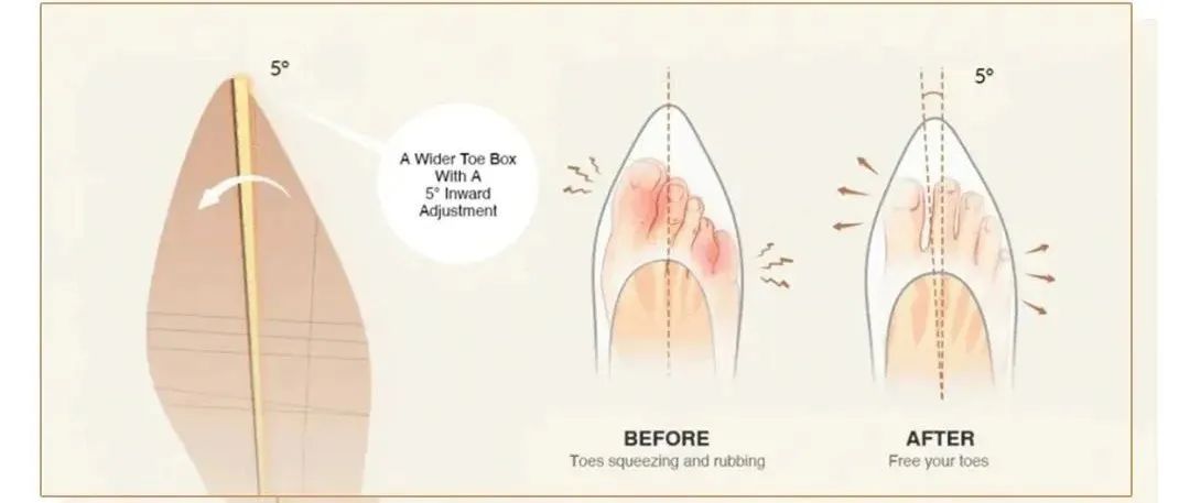 海外狂卖20亿国内却没几个人知道OG真人游戏6个塑料瓶做一双鞋(图9) 海外狂卖20亿国内却没几个人知道OG真人游戏6个塑料瓶做一双鞋(图9)
